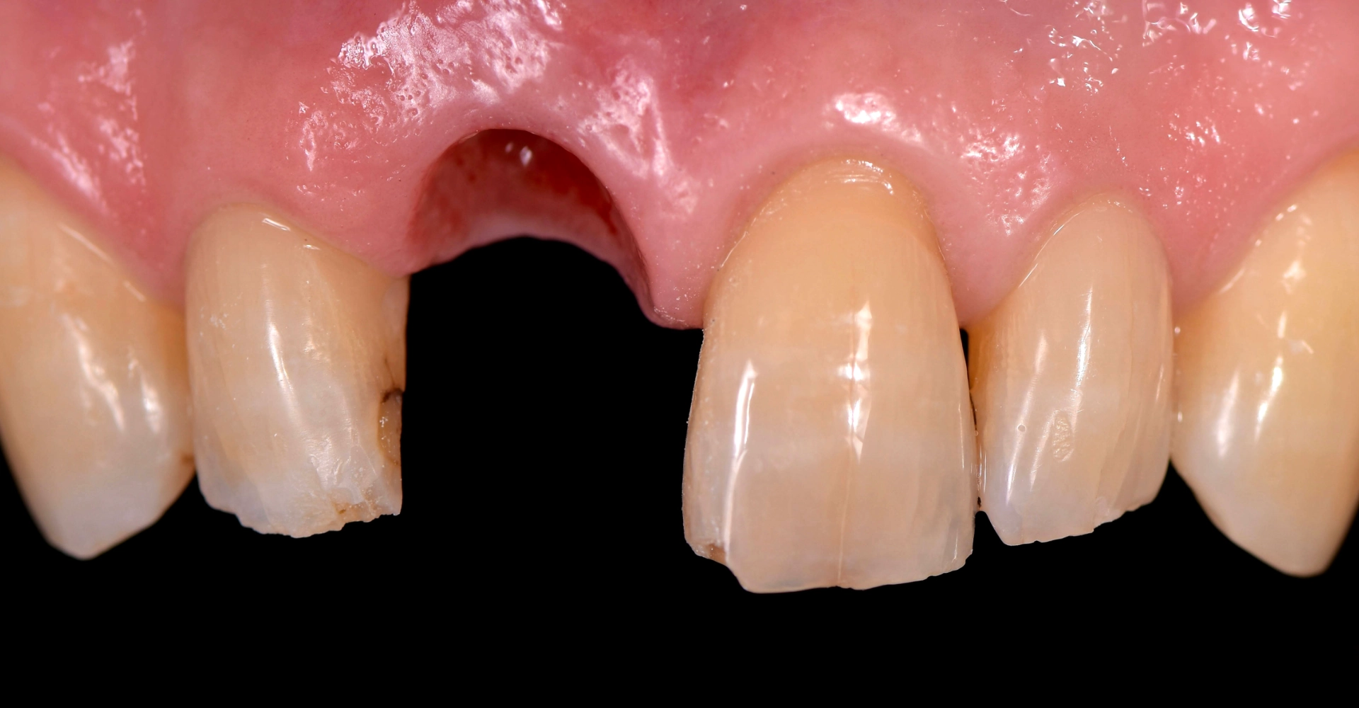Cas clinique 1