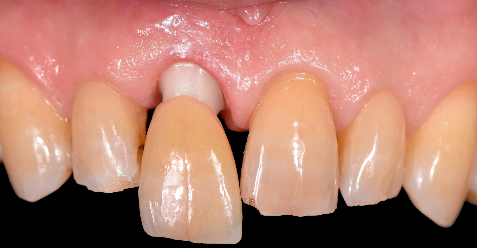 Cas clinique 2
