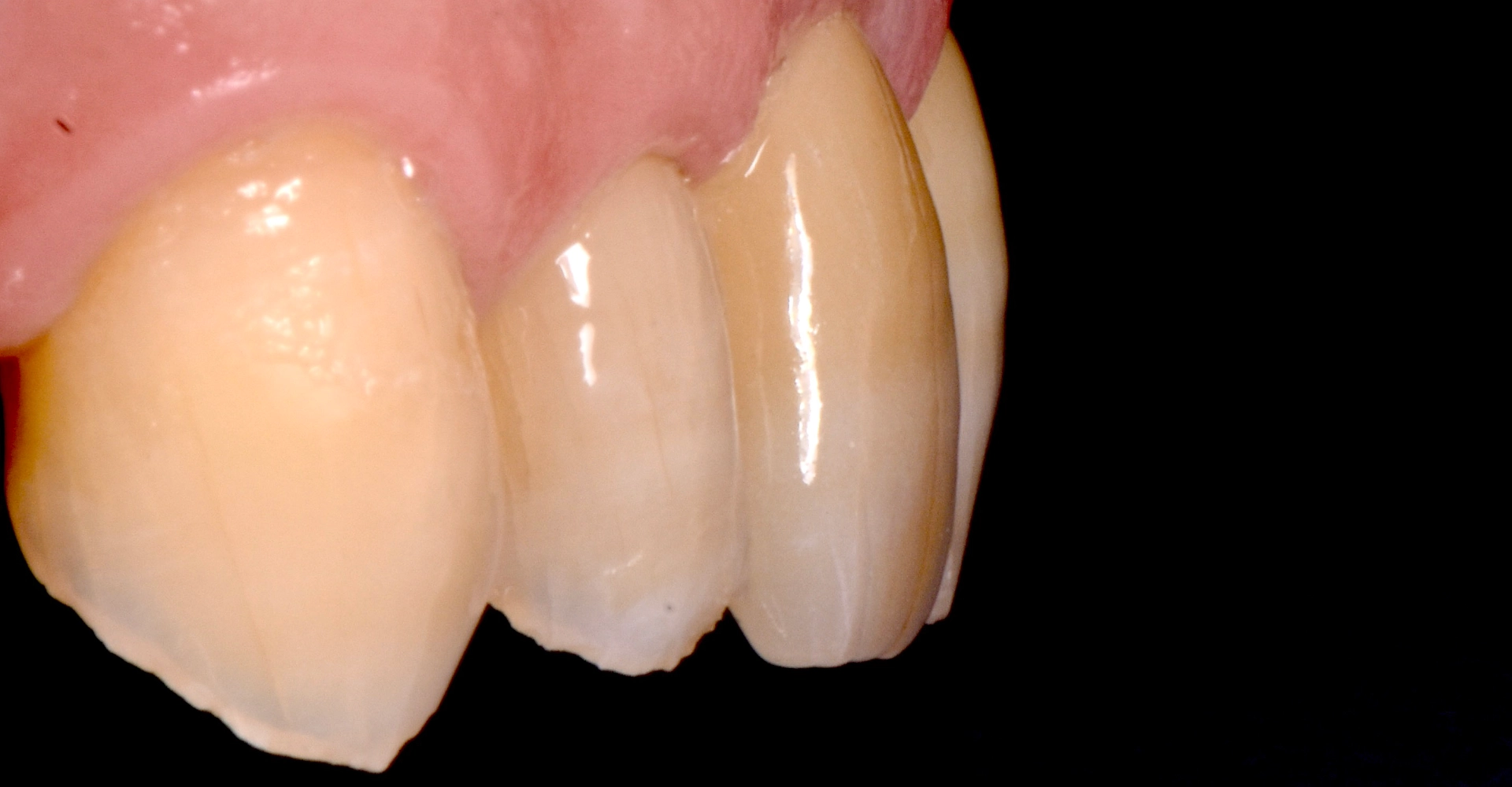 Cas clinique 4