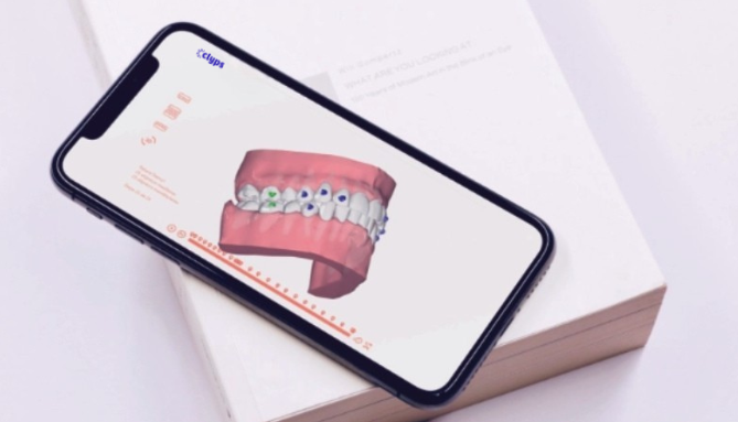 À chaque étape, votre dentiste valide les résultats et vous accompagne jusqu’au sourire final.